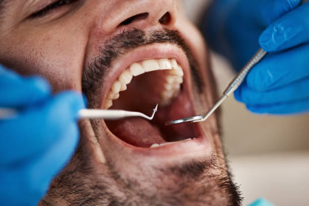 Best Broken or Cracked Tooth Emergency Dentist in Juno Ridge, FL
